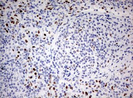 m00548 1 anti areb6 zeb1 mouse monoclonal antibody clone id oti3g6 ihc testing 7