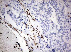 m00548 1 anti areb6 zeb1 mouse monoclonal antibody clone id oti3g6 ihc testing 8