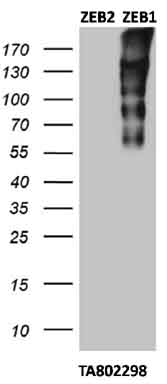 Cross-reactivity test with ZEB2: HEK293T cells were transfected with plasmids overexpressing either ZEB2 (left) or ZEB1 (right) and immunoblotted with anti-ZEB1 (M00548-1)