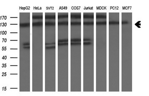 Western blot analysis of extracts (35ug) from 9 different cell lines by using anti-ZEB1 monoclonal antibody at 1:200 dilution