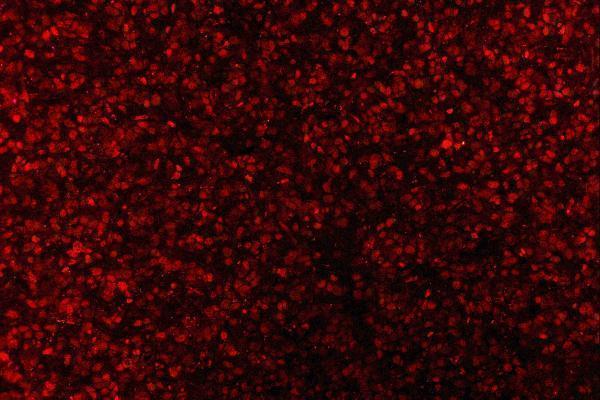 m00548 2 zeb1 primary antibodies if testing 11