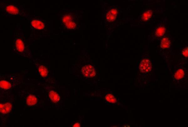 m00548 2 zeb1 primary antibodies if testing 12