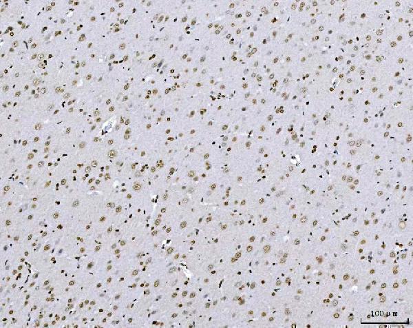 m00548 2 zeb1 primary antibodies ihc testing 10