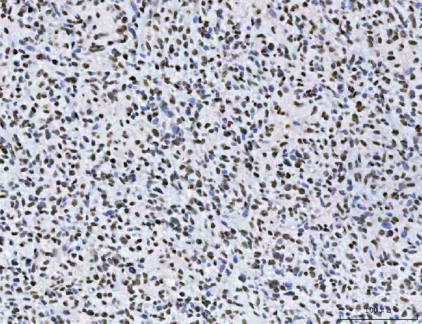  IHC analysis of AREB6/ZEB1 using anti-AREB6/ZEB1 antibody (M00548-2)