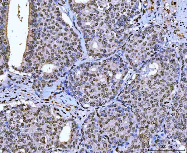 m00548 2 zeb1 primary antibodies ihc testing 4