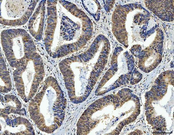 m00548 2 zeb1 primary antibodies ihc testing 5