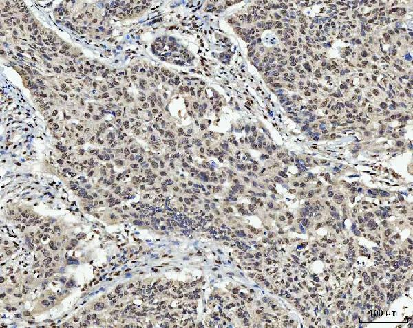 m00548 2 zeb1 primary antibodies ihc testing 6