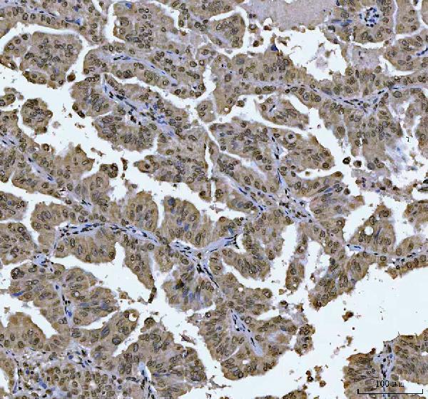 m00548 2 zeb1 primary antibodies ihc testing 7