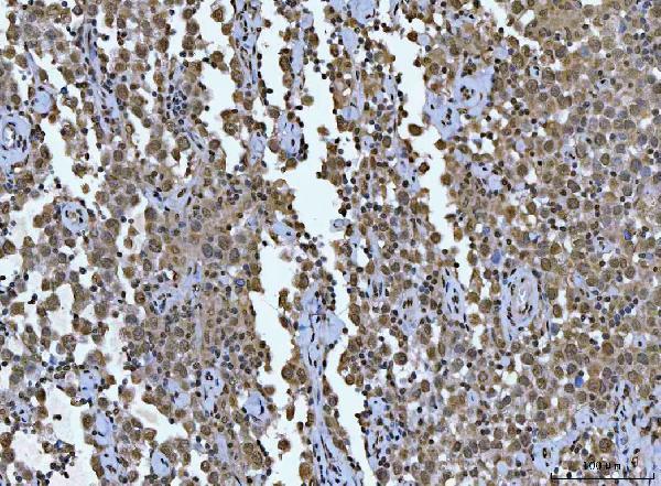 m00548 2 zeb1 primary antibodies ihc testing 8