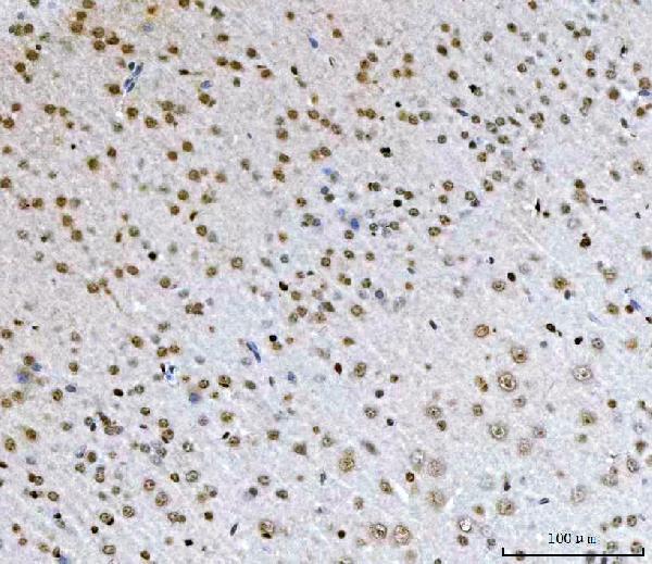 m00548 2 zeb1 primary antibodies ihc testing 9