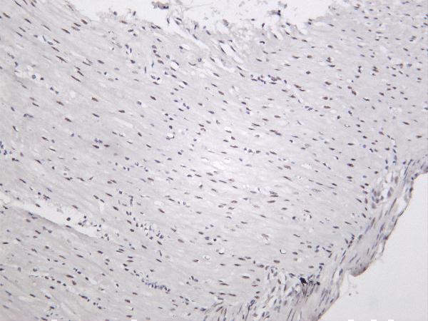 Rat colon was stained with anti-ZEB1 rabbit antibody