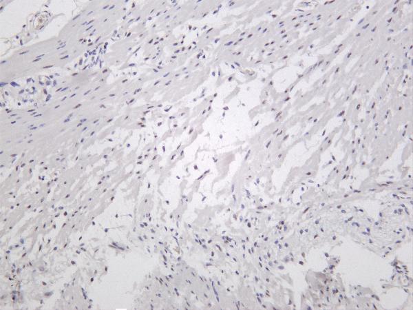 Human colon was stained with anti-ZEB1 rabbit antibody