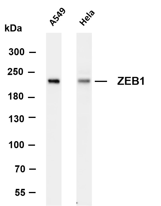 Various whole cell lysates were separated by 4-8% SDS-PAGE, and the membrane was blotted with anti-ZEB1 antibody