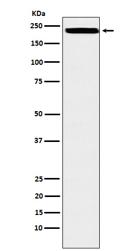 Western blot analysis of AREB6 expression in HEK293 cell lysate