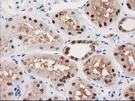 m00551 anti gale mouse monoclonal antibody clone id oti1c4 ihc testing 11