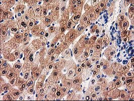 m00551 anti gale mouse monoclonal antibody clone id oti1c4 ihc testing 12