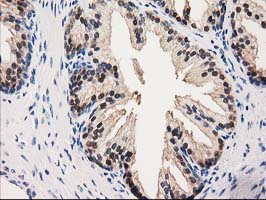 m00551 anti gale mouse monoclonal antibody clone id oti1c4 ihc testing 5