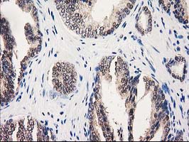 m00551 anti gale mouse monoclonal antibody clone id oti1c4 ihc testing 6