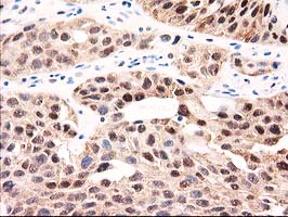 m00551 anti gale mouse monoclonal antibody clone id oti1c4 ihc testing 7
