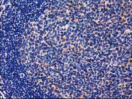 m00551 anti gale mouse monoclonal antibody clone id oti1c4 ihc testing 8