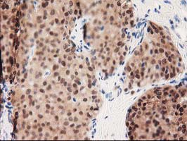 m00551 anti gale mouse monoclonal antibody clone id oti1c4 ihc testing 9