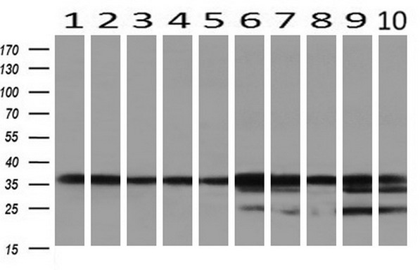 m00551 anti gale mouse monoclonal antibody clone id oti1c4 wb testing 2