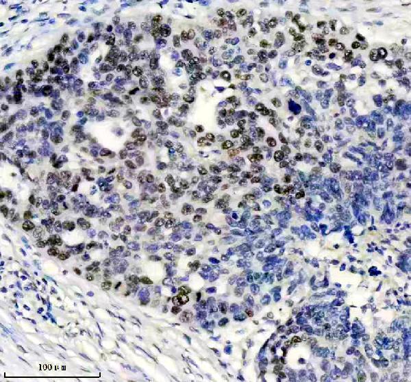 m00553 msh6 primary antibodies ihc testing 3