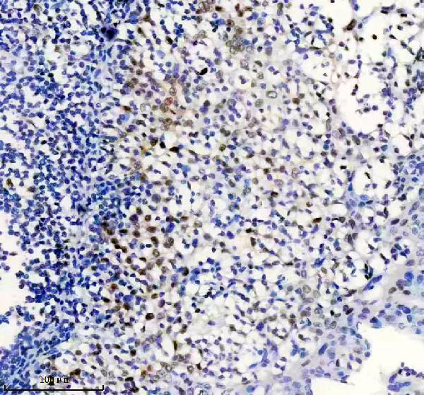 m00553 msh6 primary antibodies ihc testing 4