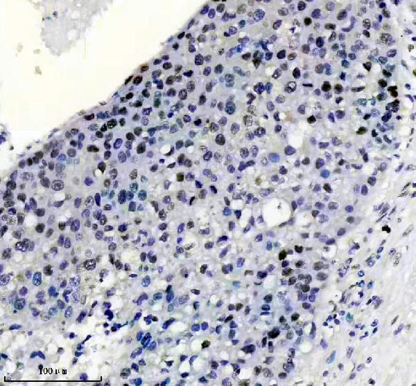 m00553 msh6 primary antibodies ihc testing 5