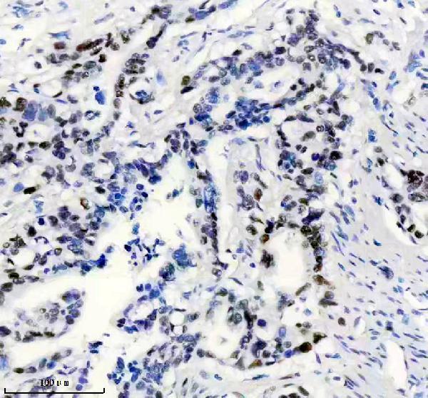 m00553 msh6 primary antibodies ihc testing 6