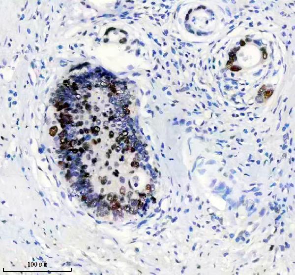 m00553 msh6 primary antibodies ihc testing 7