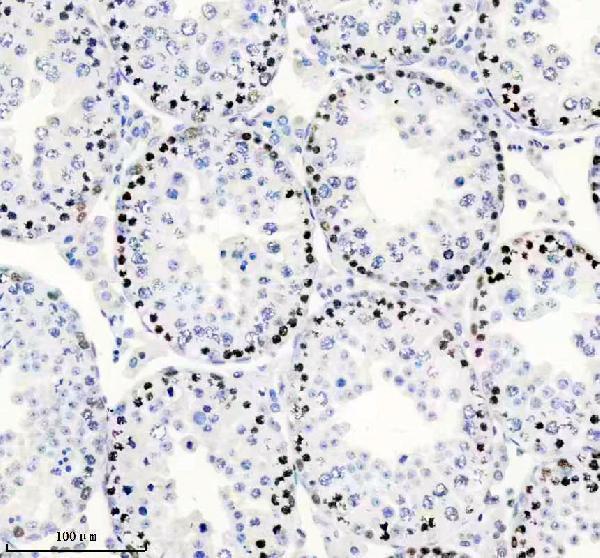 m00553 msh6 primary antibodies ihc testing 8