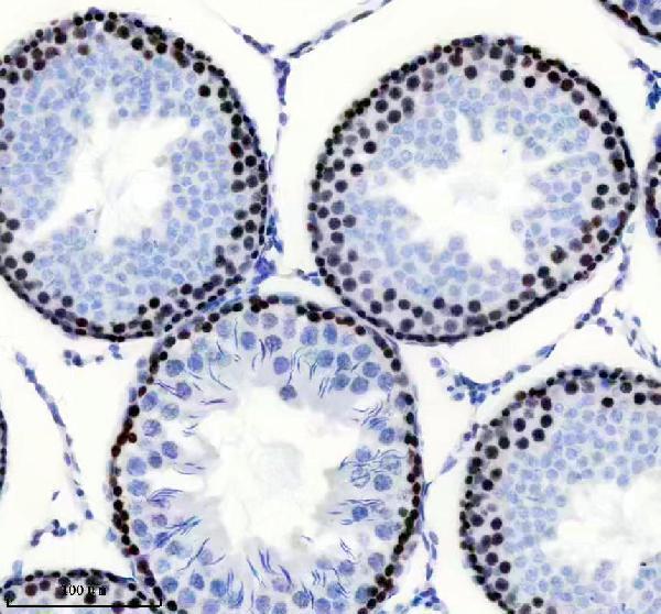 m00553 msh6 primary antibodies ihc testing 9