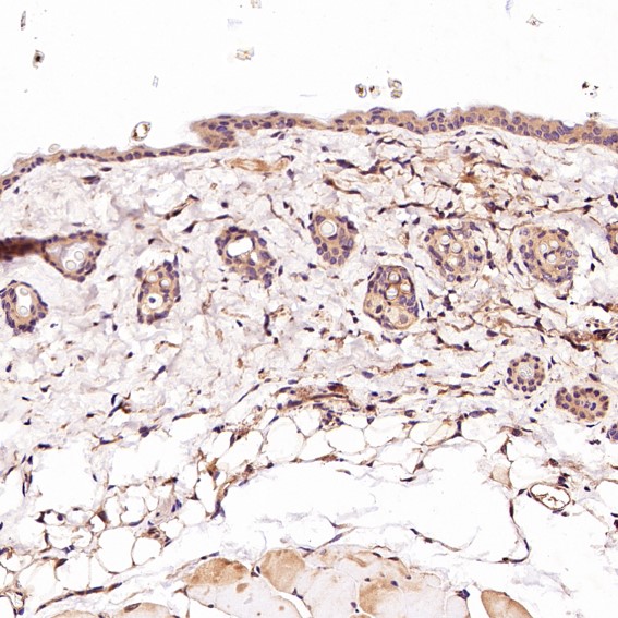 m00555 1 ihc10