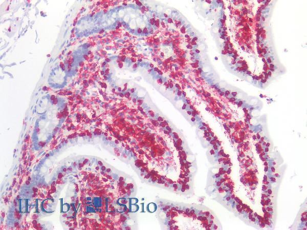 m00555 3 hu cd45 primary antibodies ihc testing 2