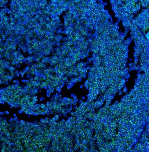 m00555 5 cd45 primary antibodies if testing 3