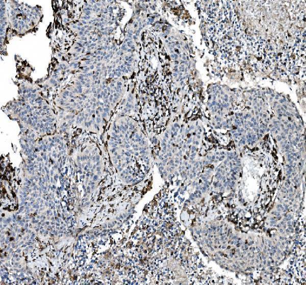  IHC analysis of CD45 using anti-CD45 antibody (M00555-5)
