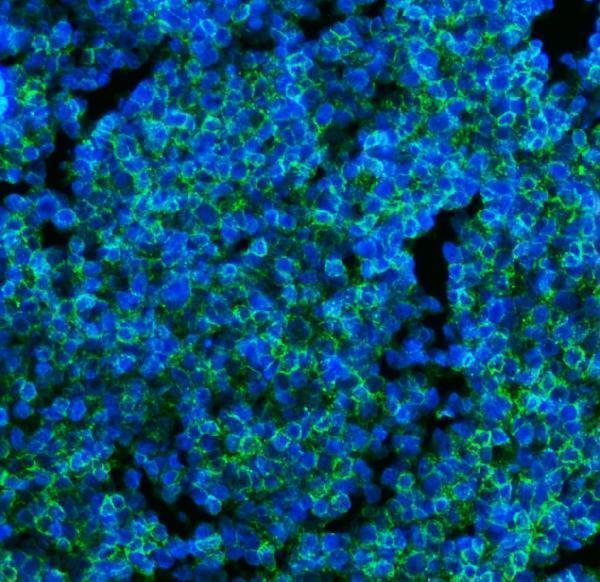  IF analysis of CD45 using anti-CD45 antibody (M00555-6)