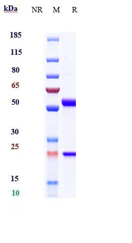 Anti-PTPRC/CD45 Reference Antibody (Novartis patent anti-CD45) on SDS-PAGE under reducing (R) condition