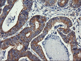 m00556 2 anti drp1 dnm1l mouse monoclonal antibody clone id oti4f6 ihc testing 7
