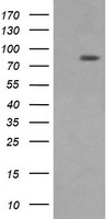 HEK293T cells were transfected with the pCMV6-ENTRY control (Left lane) or pCMV6-ENTRY DNM1L (Right lane) cDNA for 48 hrs and lysed