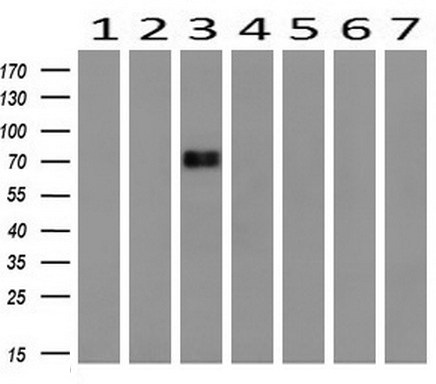 Western blot analysis of extracts (10ug) from 7 Human tissue by using anti-DNM1L monoclonal antibody ( 1: Uterus; 2: Breast; 3: Brain; 4: Liver; 5: Ovary; 6: Thyroid gland; 7: colon) at 1:200 dilution