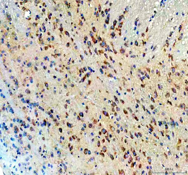 IHC analysis of P-DRP1 using anti-P-DRP1 antibody (M00556-4)
