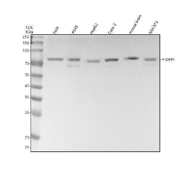 Western blot analysis of P-DRP1 using anti-P-DRP1 antibody (M00556-4)