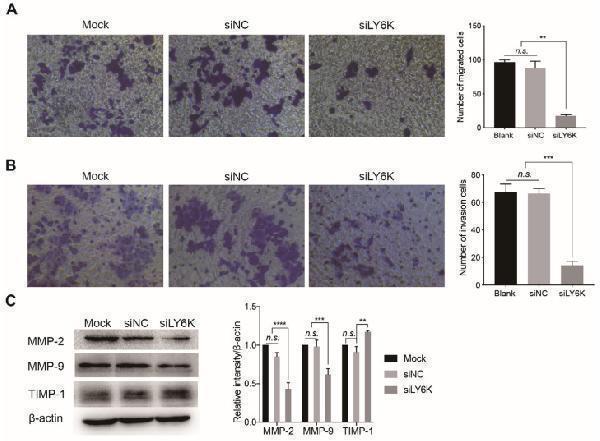 Knockdown of LY6K inhibits migration and invasion of CCSCs in vitro
