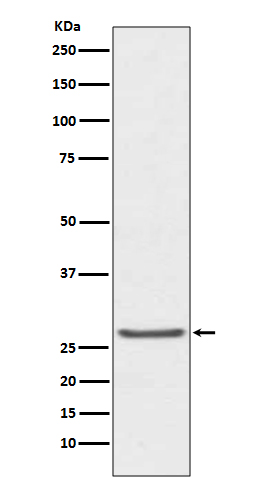 Western blot analysis of TIMP1 expression in human prostate cancer lysate