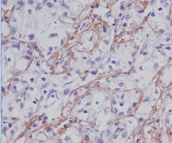 m00564 1 ihc