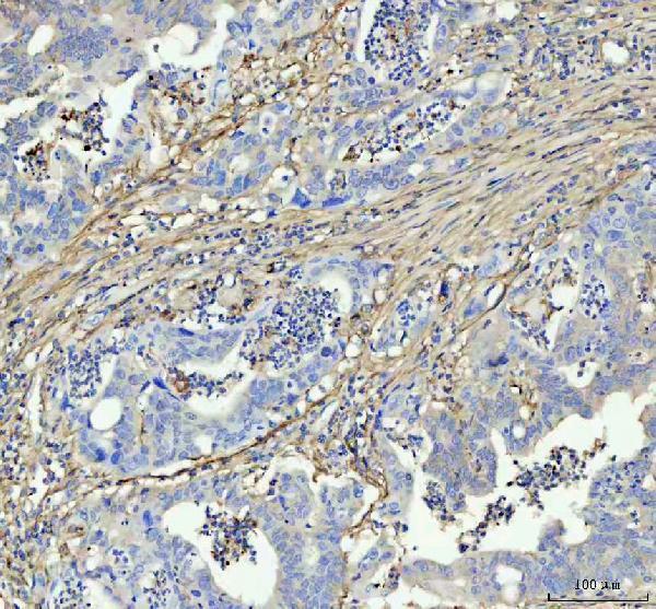 m00564 3 fibronectin primary antibodies ihc testing 2