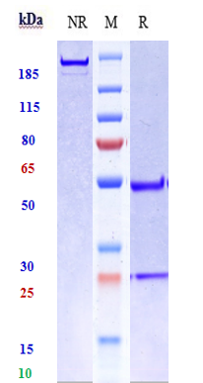 Anti-Fibronectin Reference Antibody (radretumab) on SDS-PAGE under reducing (R) condition