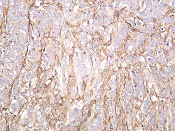 Human breast was stained with anti-Fibronectin rabbit antibody